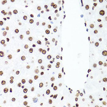 Immunohistochemistry - H1F0 Polyclonal Antibody (144-03298)
