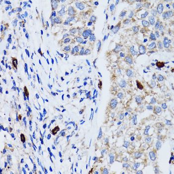 Immunohistochemistry - MAP1LC3B Polyclonal Antibody (144-07198)