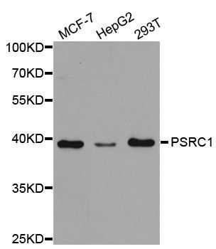 Western blot - PSRC1 antibody (144-05484)