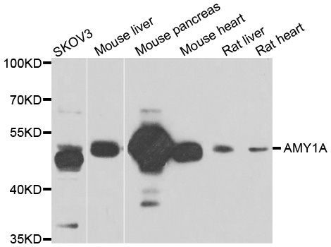 Western blot - AMY1A antibody (144-06867)