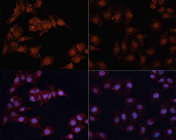 Immunohistochemistry - MAP1LC3B Polyclonal Antibody (144-11282)