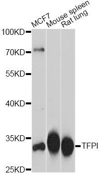 Western blot - TFPI antibody (144-600902)