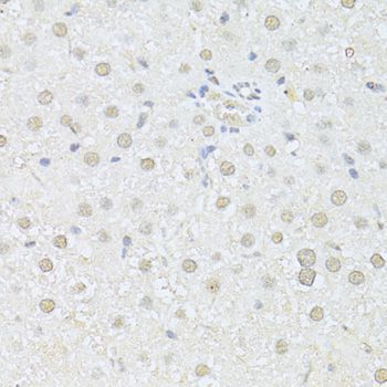 Immunohistochemistry - AKT1 Polyclonal Antibody (144-011016)