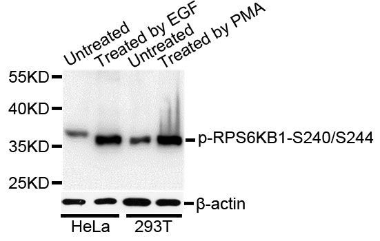 Western blot - Phospho-RPS6-S240/244 pAb (144-50537)