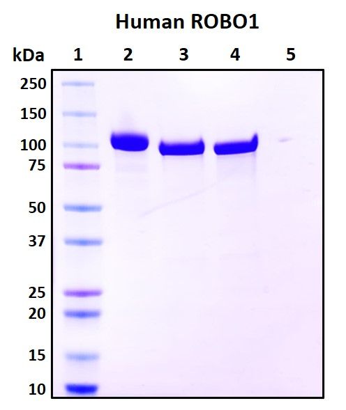 SDS-PAGE