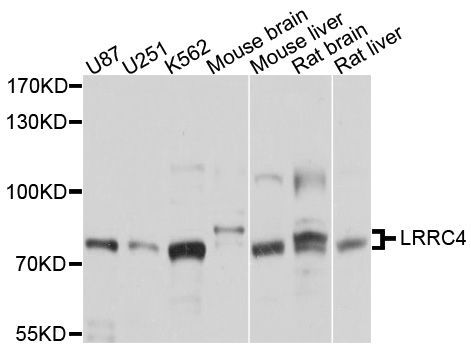Western blot - LRRC4 Polyclonal Antibody (144-010321)