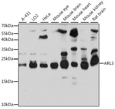 Western blot