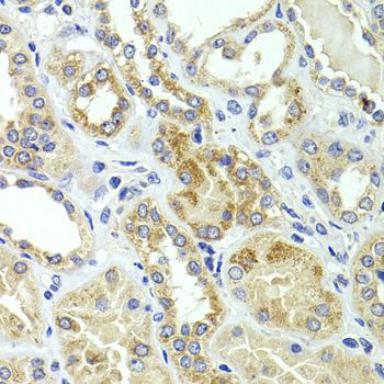 Immunohistochemistry - HMGCL antibody (144-08052)