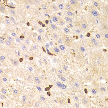 Immunohistochemistry - LSP1 Antibody (144-05617)