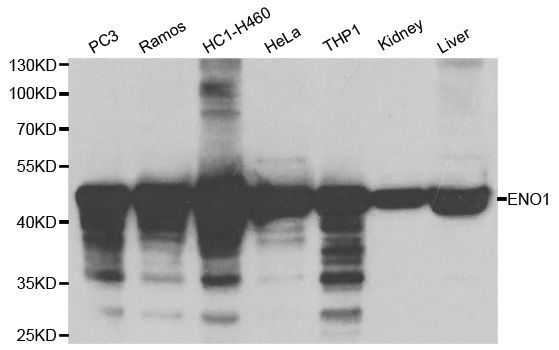 Western blot - ENO1 Polyclonal Antibody (144-01033)