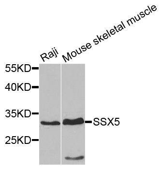 Western blot - SSX5 antibody (144-07732)