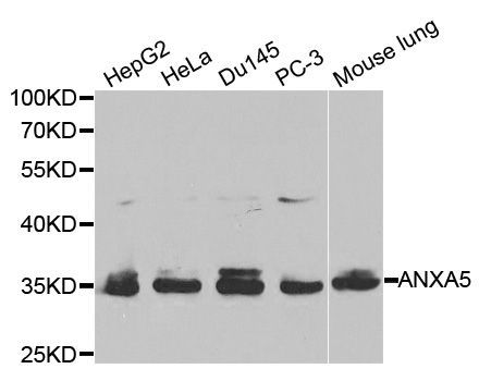 Western blot - [KO Validated] ANXA5 Polyclonal Antibody (144-01728)