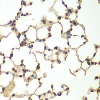 Immunohistochemistry - USF1 antibody (144-60393)