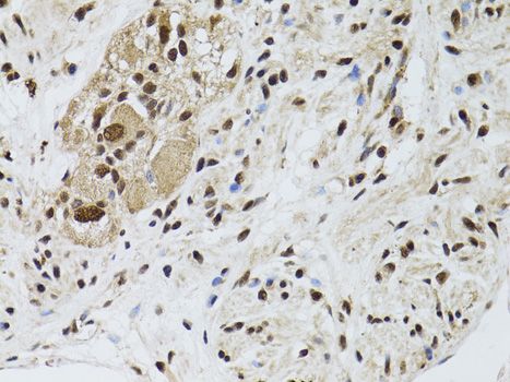 Immunohistochemistry - STK11 antibody (144-02122)