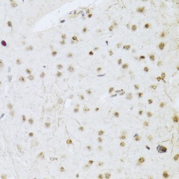 Immunohistochemistry - MAPK3 Polyclonal Antibody (144-00228)