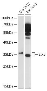 Western blot