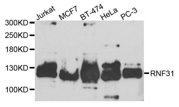 Western blot - RNF31 antibody (144-08227)