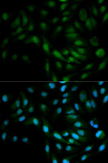 Western blot - MAPK7 Polyclonal Antibody (144-02111)