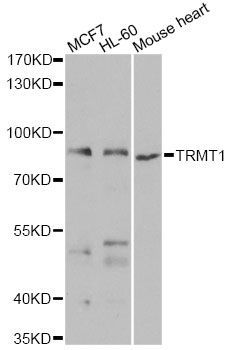 Western blot - TRMT1 antibody (144-07116)