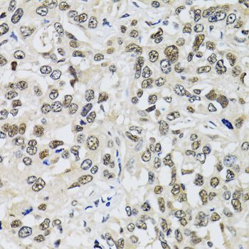 Immunohistochemistry - TP53BP1 antibody (144-05757)
