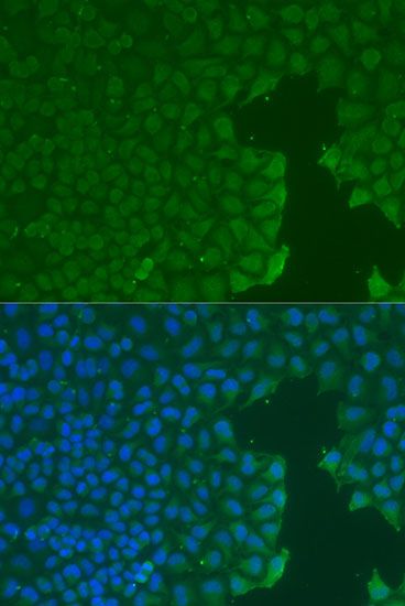 Immunofluorescence - PECAM1 Polyclonal Antibody (144-60020)