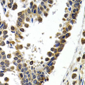 Immunohistochemistry - ATF2 Polyclonal Antibody (144-02155)