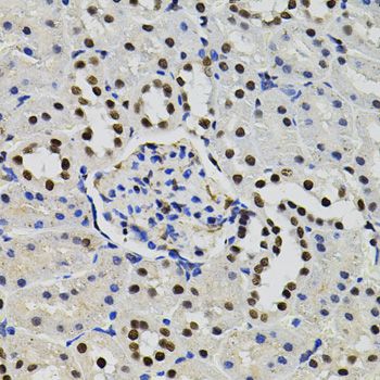 Immunohistochemistry - GTF2I antibody (144-07898)
