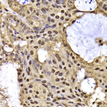Immunohistochemistry - ARID3A Polyclonal Antibody (144-07668)