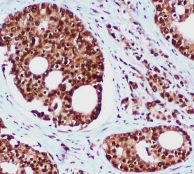 IHC