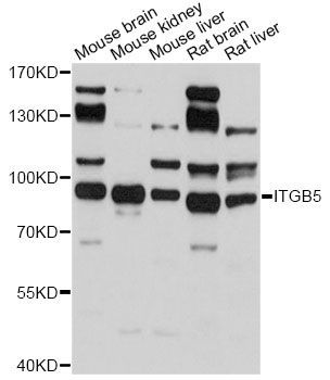 Western blot - ITGB5 antibody (144-02497)