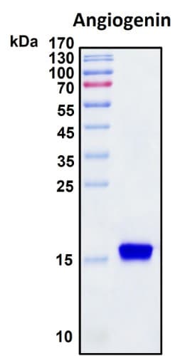 SDS-PAGE Image
