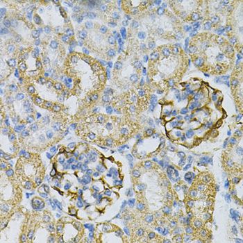 Immunohistochemistry - AK1 Polyclonal Antibody (144-603440)