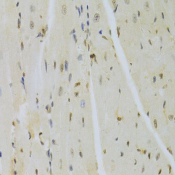 Immunohistochemistry - HMGB1 Polyclonal Antibody (144-02553)