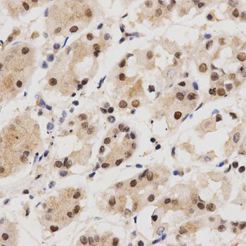 Immunohistochemistry - KPNA4 Antibody (144-02026)