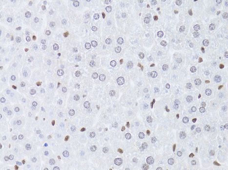 Immunohistochemistry - LMNB2 Polyclonal Antibody (144-06483)