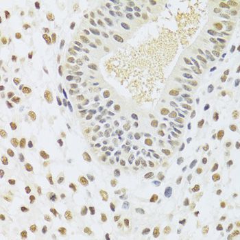 Immunohistochemistry - DDB1 Polyclonal Antibody (144-02896)