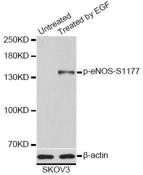 Western blot - Phospho-eNOS-S1177 antibody (144-61502)