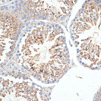 Immunohistochemistry - KLHL9 Polyclonal Antibody (144-010149)