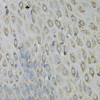 Immunohistochemistry - RPLP0 Antibody (144-013633)