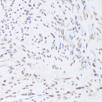 Immunohistochemistry - HNRNPD Polyclonal Antibody (144-01828)
