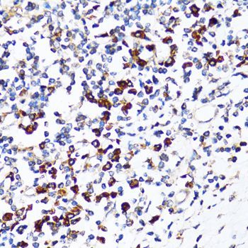 Immunohistochemistry - RPN1 antibody (144-600827)