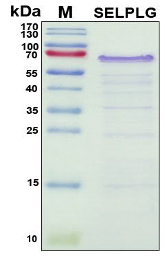 SDS-PAGE