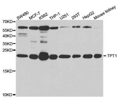 Western blot - TPT1 Polyclonal Antibody (144-05442)