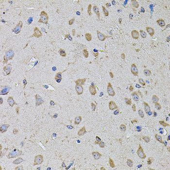 Immunohistochemistry - PTCD3 Polyclonal Antibody (144-08497)