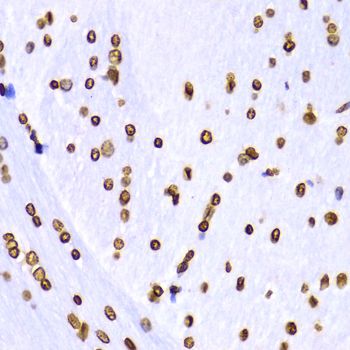 Immunohistochemistry - TriMethyl-Histone H3-K9 antibody (144-02360)