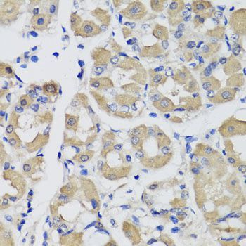 Immunohistochemistry - PSPH antibody (144-07924)