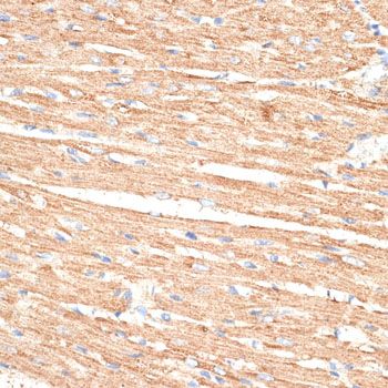 Immunohistochemistry - KLHL9 Polyclonal Antibody (144-010149)