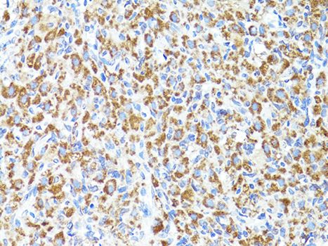 Immunohistochemistry - S100A10 antibody (144-60742)