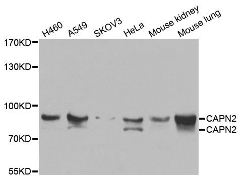 Western blot - [KO Validated] CAPN2 Polyclonal Antibody (144-01861)
