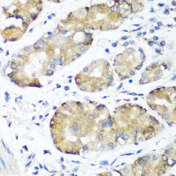 Immunohistochemistry - NOTCH2 Polyclonal Antibody (144-00560)